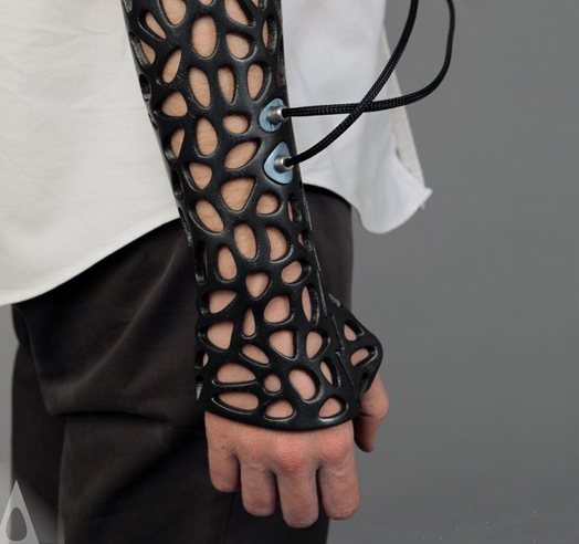 Osteoid 3D-printed medical cast by Deniz Karasahin of DK Design 